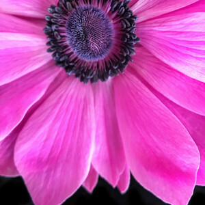 ExoLens with Optics by ZEISS Macro Lens - Thumbnail
